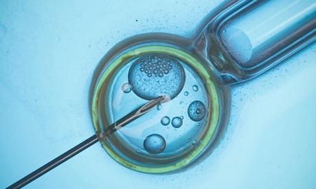 human embryo